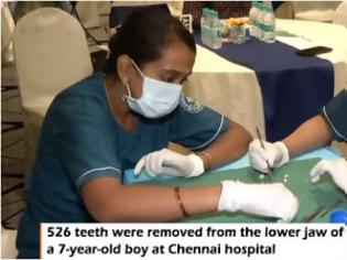 Φωτογραφία για Απίστευτο: Αφαίρεσαν από 7χρονο παιδί 526 δόντια