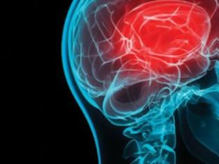 Φωτογραφία για Εγκεφαλικό: Αυτά είναι τα συμπτώματα – Βασικός οδηγός για όλους (video)