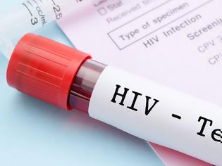 Φωτογραφία για AIDS: Γενετική μετάλλαξη δημιουργεί «φυσική ανοσία» στον ιό HIV