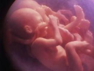 Φωτογραφία για Διάλογος δύο Εμβρύων: Υπάρχει Ζωή Μετά τη ... Γέννα;