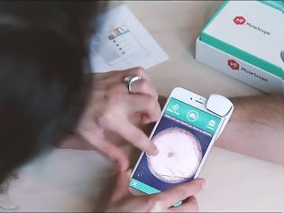 Φωτογραφία για Πώς να χρησιμοποιήσετε το smartphone σας για να ελέγξετε για καρκίνο του δέρματος