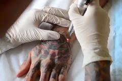 Η E.E. ζητά την απαγόρευση των τατουάζ μπλε και πράσινου χρώματος