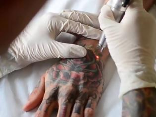 Φωτογραφία για Η E.E. ζητά την απαγόρευση των τατουάζ μπλε και πράσινου χρώματος