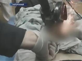 Φωτογραφία για Ουκρανή πέρασε παξιμάδι στο πέος του άπιστου συντρόφου της – Του το έβγαλαν με τροχό