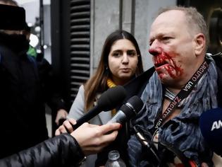 Φωτογραφία για Άγριος ξυλοδαρμός γερμανού δημοσιογράφου από ακροδεξιούς στο Σύνταγμα