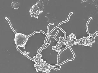 Φωτογραφία για H προέλευση πολύπλοκων μορφών ζωής στη Γη μέσα από ένα παράξενο μικρόβιο