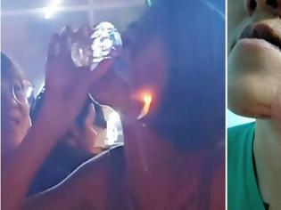 Φωτογραφία για Βίντεο: Νεαρή ήπιε σφηνάκι τεκίλα με... φωτιά και κάηκε το πρόσωπό της