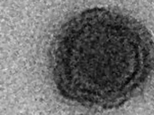 Φωτογραφία για Yaravirus : Μυστηριώδης ιός εντοπίστηκε στη Βραζιλία