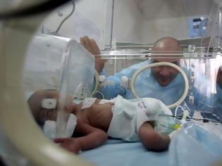 Φωτογραφία για Μωρό γεννήθηκε με… νεύρα -Το «απειλητικό» βλέμμα στο γιατρό (video)