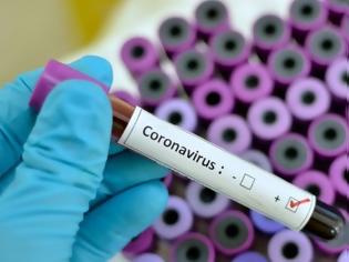 Φωτογραφία για Κορωνοϊός: Πόσες ημέρες επιβιώνει ο ιός στις επιφάνειες