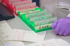 Τεστ για τον κορωνοϊό: Γιατί οι περισσότερες χώρες στον κόσμο δεν εφαρμόζουν στρατηγική Νότιας Κορέας