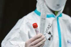 Sanofi και Regeneron επεκτείνουν εκτός ΗΠΑ κλινική δοκιμή πιθανής θεραπείας