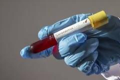 Επιστολή του ΠΦΣ προς τους Υπουργούς Υγείας, τον Πρόεδρο του ΕΟΦ και του ΕΟΔΥ για τα TEST COVID-19