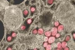 Πόσα σωματίδια κοροναϊού χρειάζονται για να αρρωστήσει κανείς και μάλιστα σοβαρά;