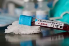 Ανησυχητική έρευνα: Ένα στα τρία κρούσματα μπορεί να βγει αρνητικό στα τεστ