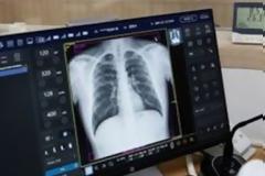 ΕΚΠΑ: Με αυτή την πανδημία δεν έχουμε τελειώσει