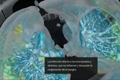 Πώς «επιτίθεται» ο ιός στον οργανισμό μας