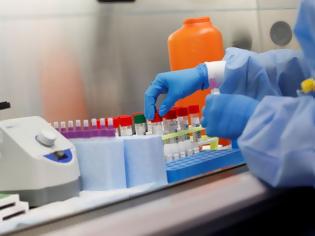 Φωτογραφία για Πάνω από 110 «υποψήφια» εμβόλια για τον κοροναϊό – Τα τελευταία ερευνητικά δεδομένα από τον Η. Μόσιαλο