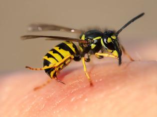 Φωτογραφία για Πρώτες βοήθειες για τσίμπημα μέλισσας, σφήκας (σφίγγας ή σφήγκας). Πώς να αφαιρέσετε το κεντρί; Αντιμετώπιση αλλεργικής αντίδρασης