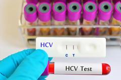 Στα 22 εκατομμύρια ευρώ ο 