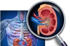 ΕΚΠΑ: COVID -19 και Νεφρός. Κοροναϊός και Οξεία Νεφρική Βλάβη