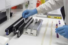 Αμερικανικός στρατός: Η νόσος πρόεκυψε φυσικά