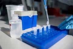 Εθνικό Μητρώο Ασθενών COVID-19. Τα κριτήρια και οι σκοποί λειτουργίας του