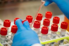 Η Οδύσσεια των δειγμάτων κοροναϊού. Διαμαρτυρία γιατρών Λέρου, Πάτμου, Λειψών