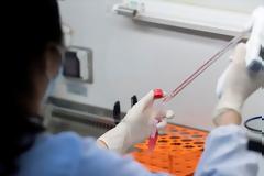 Covid-19: Η θεωρία του εργαστηρίου και οι αποδείξεις που επικαλούνται οι ΗΠΑ