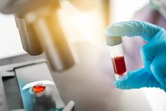 Κορωνοϊός: Η παρουσία αντισωμάτων δεν συνεπάγεται ανοσία, λέει ο Παγκόσμιος Οργανισμός Υγείας