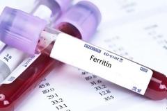 Σημαντική η προγνωστική αξία της φερριτίνης. Δείχνει αν κάποιος θα νοσήσει βαριά από τον κοροναϊό