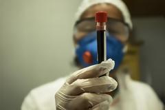 Κι όμως η φερριτίνη μας μπορεί να δείξει αν θα νοσήσουμε σοβαρά από κορωνοϊό!