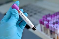 Κορωνοϊός: Έως και 60% περισσότερα τα θύματα, εκτιμούν οι Financial Times