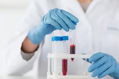 Δίνει ελπίδες το νέο τεστ αίματος για την έγκαιρη διάγνωση πολλών καρκίνων ταυτόχρονα
