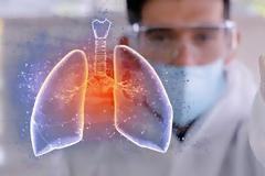 Εξαιρετικά νέα: Εγκρίνει την ρεμδεσιβίρη άμεσα o FDA για θεραπεία από τον κοροναϊό