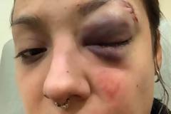 Γυναίκες δείχνουν το πρόσωπό τους και στέλνουν ένα δυνατό μήνυμα