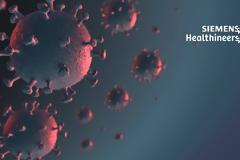 Εξέταση ολικών αντισωμάτων από την Siemens Healthineers για κοροναϊό δίνει αποτέλεσμα σε 14 λεπτά
