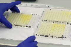 Μονοκλωνικό αντίσωμα που μπλοκάρει τη μόλυνση από τον κορωνοϊό ανακάλυψαν Ολλανδοί επιστήμονες