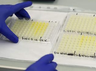 Φωτογραφία για Μονοκλωνικό αντίσωμα που μπλοκάρει τη μόλυνση από τον κορωνοϊό ανακάλυψαν Ολλανδοί επιστήμονες