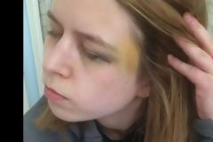 Vegan ξυλοκόπησε τη φίλη του με μπουκάλι ξύδι γιατί... μύριζε μπέικον!