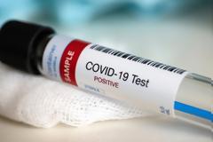 Κορωνοϊός: Ποιοι και πότε θα μπορούν να κάνουν δωρεάν τη μοριακή εξέταση