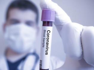 Φωτογραφία για Το πρώτο εμβόλιο που εξουδετερώνει τον κοροναϊό, στην Ιταλία