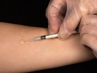 Φωτογραφία για Μόσιαλος: Οι εμβολιασθέντες για φυματίωση στην παιδική ηλικία δεν προστατεύονται από κοροναϊό
