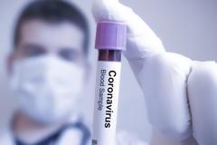 Εμβόλιο: Οι ερευνητές του Πανεπιστημίου της Οξφόρδης μαζί με την AstraZeneca προχωρούν τις κλινικές δοκιμές