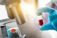 Κορωνοϊός: Σε ποιες περιοχές της Ελλάδας γίνονται μελέτες αντισωμάτων στον πληθυσμό