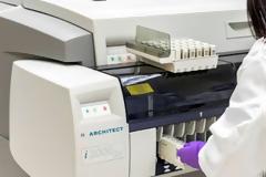 Η Abbott ανακοινώνει την άμεση διάθεση των εργαστηριακών τεστ ανίχνευσης αντισωμάτων του COVID-19 στην Ελλάδα