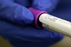 Κορονοϊός : Ο Ευρωπαϊκός ΕΟΦ διεξαγάγει αναθεώρηση για τη ρεμδεσιβίρη – Τι λέει για υδροξυχλωροκίνη