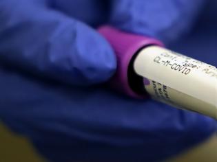 Φωτογραφία για Κορονοϊός : Ο Ευρωπαϊκός ΕΟΦ διεξαγάγει αναθεώρηση για τη ρεμδεσιβίρη – Τι λέει για υδροξυχλωροκίνη