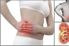 Πώς δημιουργούνται οι πέτρες στα νεφρά - νεφρολιθίαση; Ποιες τροφές, βότανα κάνουν καλό;