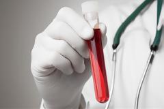 Πώς επηρεάζει η ομάδα αίματός μας τη λοίμωξη;